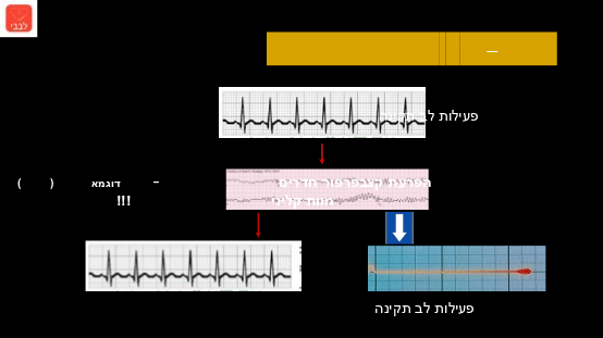 מצבי הלב לפני ואחרי דום לב